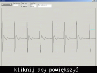 Elektrokardiograf domowej roboty Elektrokardiograf domowej roboty