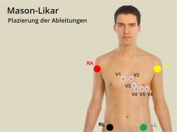 Langzeit-EKG (AD8232, Bascom, KokkeKat FAT)