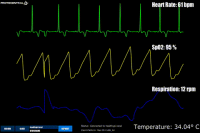 HealthyPi v3 - medyczny HAT dla Raspberry Pi