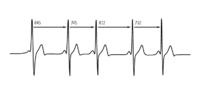 STM32F100 Keil - DMA nie zapełnia bufora ADC po pierwszym przerwaniu