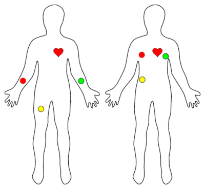Eksperymenty EKG z monitorem pracy serca (Heart Monitor), oscylografem i OpenLog
