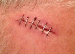 Narzędzia chirurgiczne w pracowni elektronika. Zbytek czy ideał?