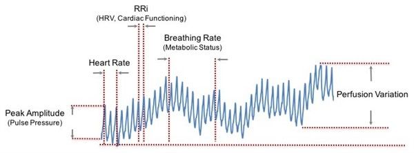 Optyczne sensory biomedyczne dla urządzeń noszonych