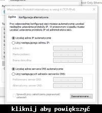TP-link TL-WR841N Router Configuration Issue: WiFi Working, No Internet on PC via LAN Port