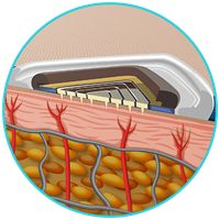 Implantowalne układy elektroniczne BioMEMS