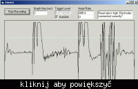 Elektrokardiograf domowej roboty Elektrokardiograf domowej roboty