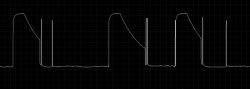 Digital Signal Waveform Digital signal waveform on a grid background.