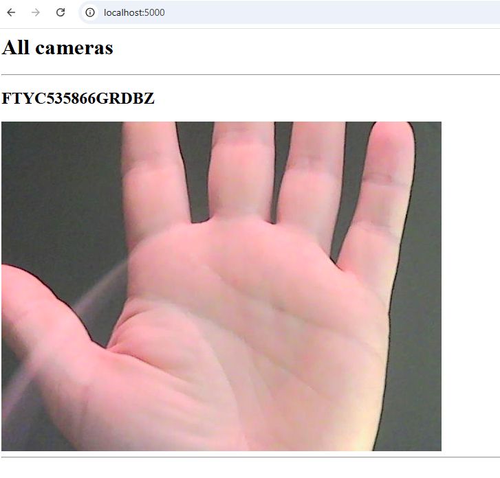 Open Hand in Front of Camera The image shows an open hand with fingers spread against a dark background.