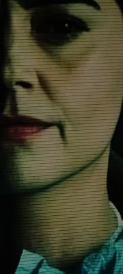 Zbliżenie twarzy na ekranie telewizora z widocznymi poziomymi paskami zakłóceń