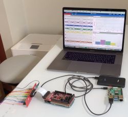 HackEEG - shield do Arduino do pomiaru EEG i EKG