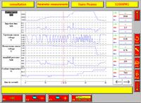Xsara Picasso 1.8 EW7J4 - Nierówna praca na Pb i LPG, wysokie spalanie, czasy wtrysków