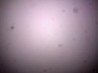 Nokia N86 - plamy na zdjęciach, serwis umywa ręce